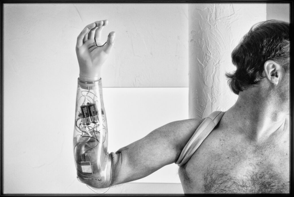 "Kenny’s Arm", Oklahoma City, Oklahoma, USA (1996)