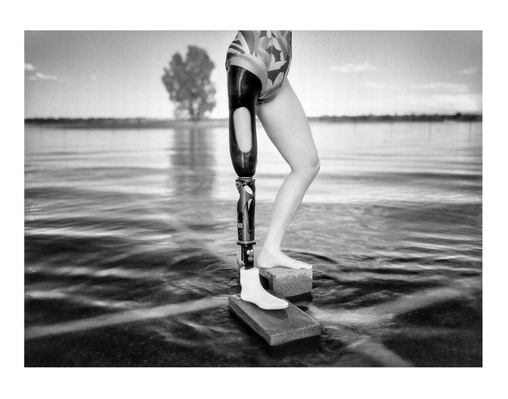 "Prosthetic Leg", Littleton, Colorado, USA (1995)